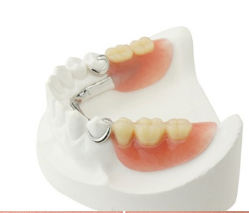 Affordable Partial Dentures in Piedmont Area