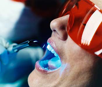 Dentist Near in Charlotte area Explains the Benefits of Ozone Therapy