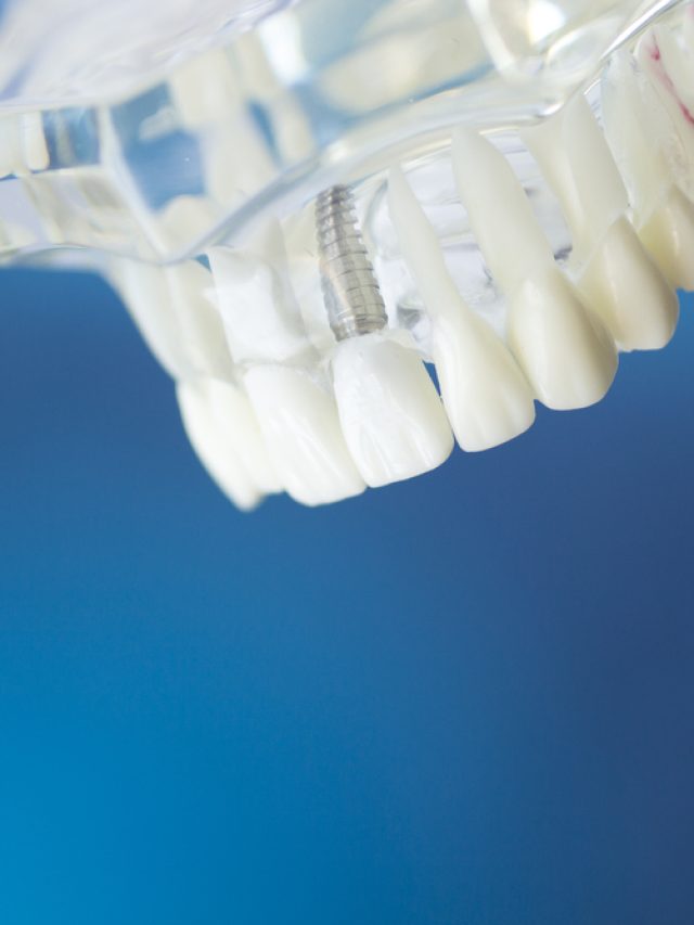 How is OZONE used in Dentistry?
