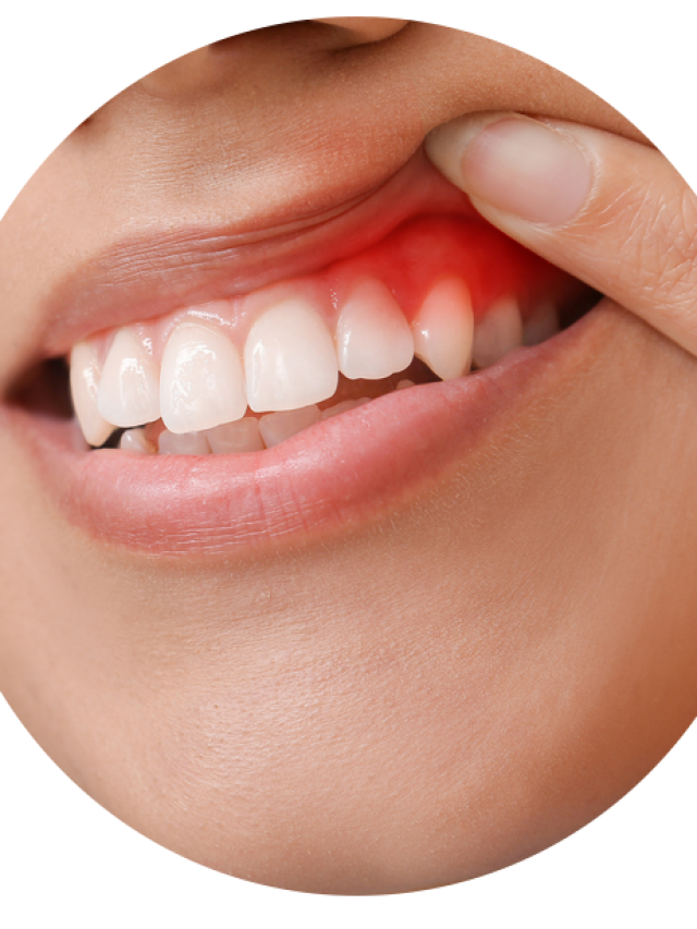 Can gum disease be genetic?